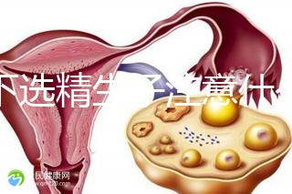 私下選精生子注意什么細節(jié)要早知，選擇正規(guī)機構(gòu)最重要