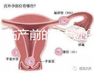 二胎臨產(chǎn)前的7大跡象，出現(xiàn)見紅、陣痛別大意