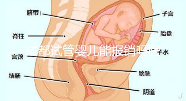 成都試管嬰兒能報銷嗎醫(yī)保？政策解讀