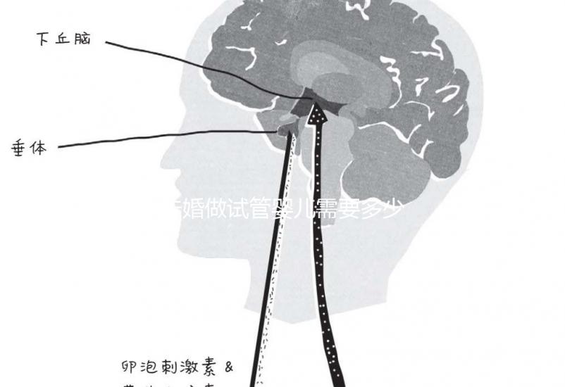 未婚做試管嬰兒需要多少錢？公立醫院費用大概在3-12萬
