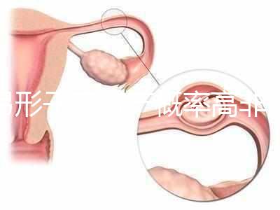 弓形子宮流產概率高非個例！罪魁禍首是這個原因