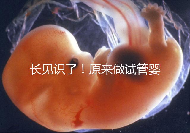 長見識了！原來做試管嬰兒，精子是這樣被篩選出來的